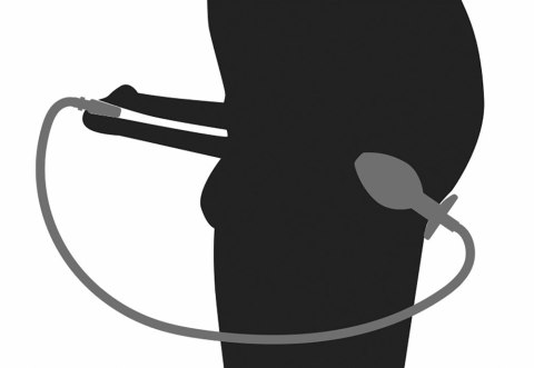 Penisplug - Korek Analny Z Wtyczką Do Stymulacji Cewki Moczowej Penisplug - Korek Analny Z Wtyczką Do Stymulacji Cewki Moczowej