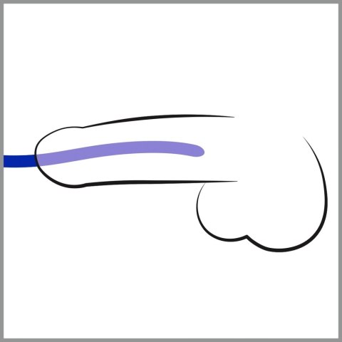 You2Toys - Rozszerzacz cewki moczowej - zestaw - 3 szt You2Toys - Rozszerzacz cewki moczowej - zestaw - 3 szt