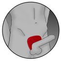 ElectraStim Silicone Fusion Viper pierścień e-stymulujący, silikonowy, 6cm